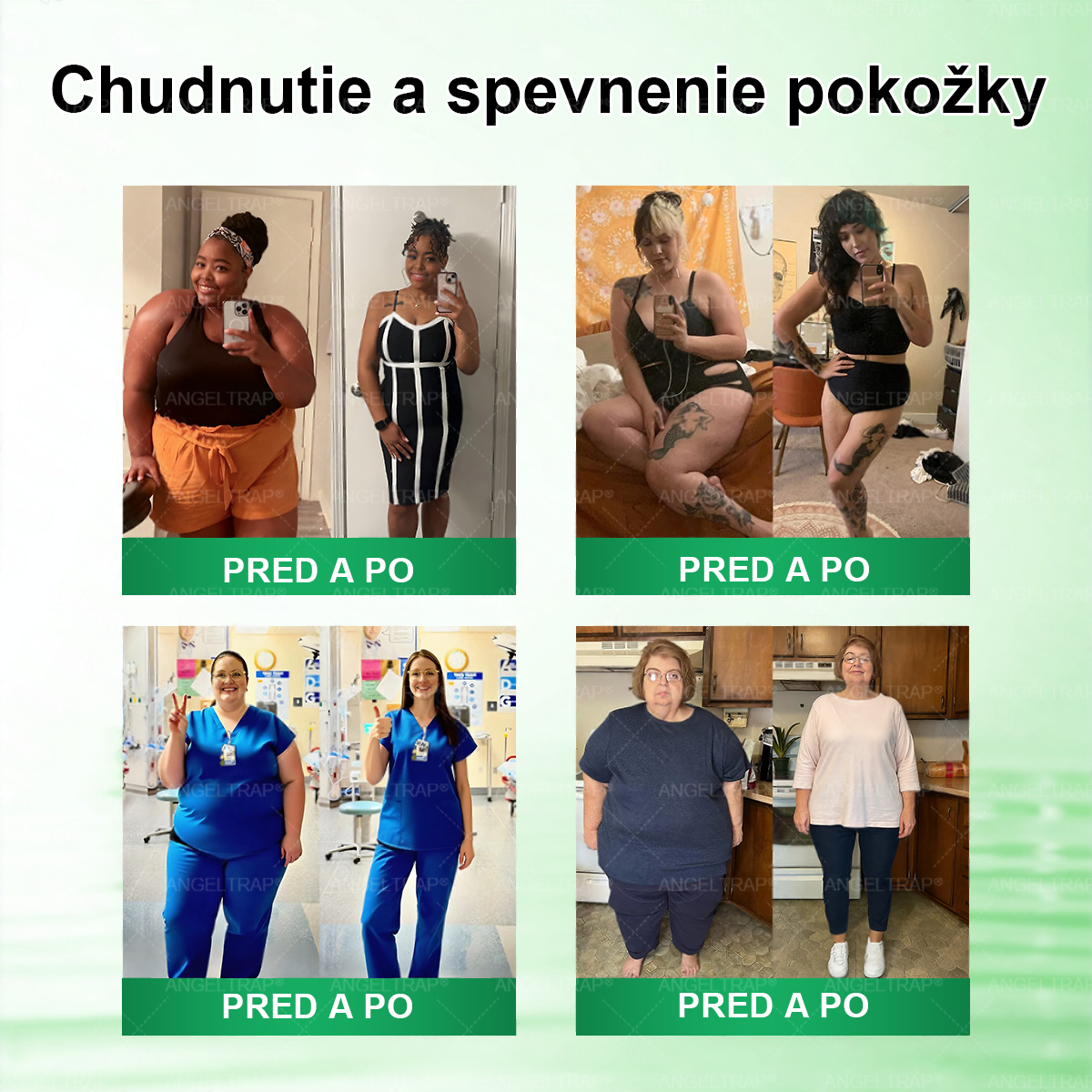 Oficiálny e-shop |💛💛𝐀𝐍𝐆𝐄𝐋𝐓𝐑𝐀𝐏® 𝑴𝒐𝒓𝒊𝒏𝒈𝒂 × 𝑩𝒆𝒓𝒃𝒆𝒓í𝒏 × 𝑨𝑴𝑷𝑲 10-𝒗-1 𝒎𝒆𝒕𝒂𝒃𝒐𝒍𝒊𝒄𝒌á 𝒑𝒐𝒅𝒑𝒐𝒓𝒏á 𝒏𝒂𝒏𝒐 𝒎𝒊𝒌𝒓𝒐𝒊𝒉𝒍𝒊č𝒌𝒐𝒗á 𝒏á𝒑𝒍𝒂𝒔ť🇸🇰 (Stačí raz denne — prvé viditeľné zmeny už po 7 dňoch) ✅ Komplexná podpora formovania postavy