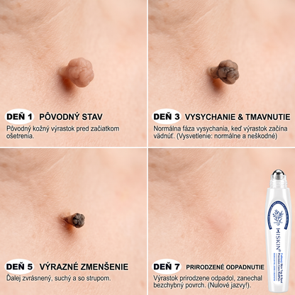 HISKIN®👩‍⚕️ BOTANICKÝ – GUMA NA ŠTÍTKY A ŠKVRNY – Bezbolestná starostlivosť o pokožku bez jaziev s pokročilým guľôčkovým aplikátorom