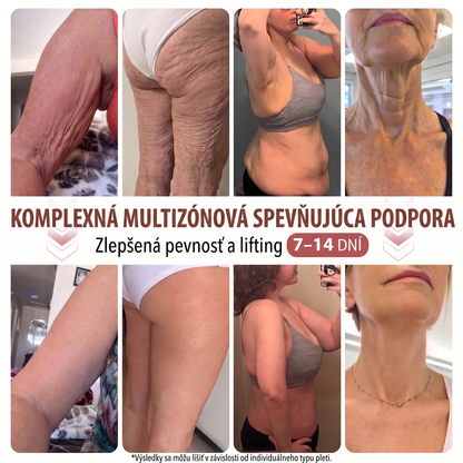 🎁🎁 🎁HISKIN® Zostáva už len 10 balení! Dávame ďalších 50% zľavu! Staraj sa o svoju formu a zdravie! Ak to teraz zmeškáš, ďalšia príležitosť až budúci rok.💪