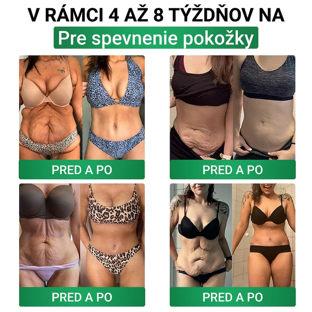 Oficiálny e-shop | 𝐂𝐔𝐒𝐈𝐉𝐀𝐒® 𝑴𝒐𝒓𝒊𝒏𝒈𝒂 · 𝘽𝙚𝙧𝙗𝙚𝙧í𝙣 × 𝑵𝑨𝑫 + 𝐍𝐚𝐧𝐨 𝒎𝒊𝒌𝒓𝒐𝒊𝒉𝒍𝒊č𝒌𝒐𝒗á 𝙣á𝙥𝙡𝙖𝙨ť 𝙣𝙖 𝒑𝒐𝒅𝒑𝒐𝒓𝒖 𝐜𝐡𝐮𝐝𝐧𝐮𝐭𝐢𝐚 𝐚 𝙯𝙙𝙧𝙖𝙫𝙞𝙖 𝒕𝒓á𝒗𝒊𝒂𝒄𝒆𝒉𝒐 𝐬𝐲𝐬𝐭é𝐦𝐮🇸🇰 (Stačí raz denne — prvé viditeľné zmeny už po 7 dňoch) ✅ Komplexná podpora formovania postavy🌷