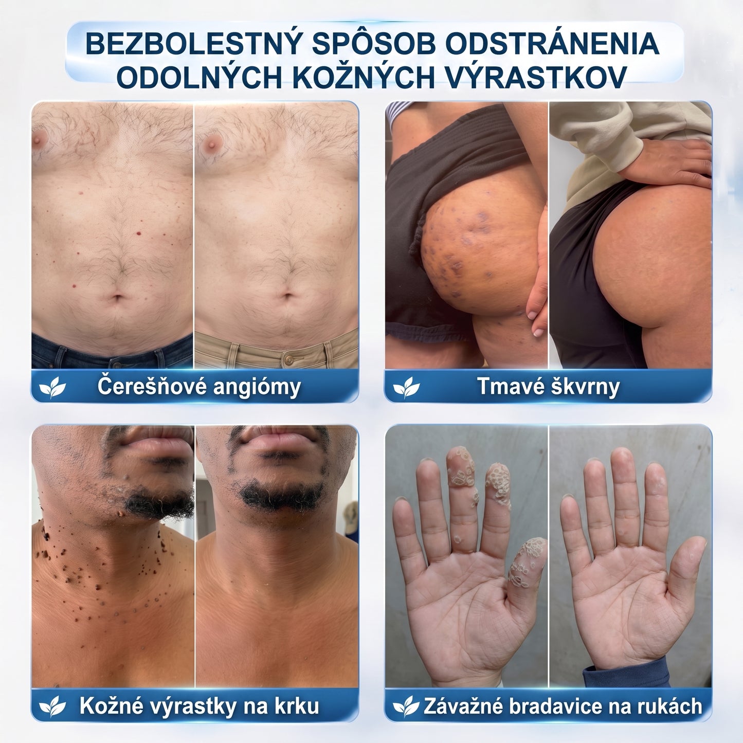HISKIN®👩‍⚕️ BOTANICKÝ – GUMA NA ŠTÍTKY A ŠKVRNY – Bezbolestná starostlivosť o pokožku bez jaziev s pokročilým guľôčkovým aplikátorom
