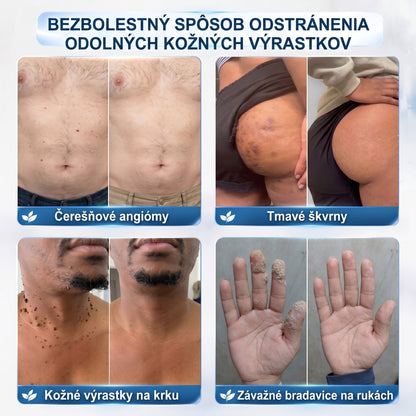 HISKIN®👩‍⚕️ BOTANICKÝ – GUMA NA ŠTÍTKY A ŠKVRNY – Bezbolestná starostlivosť o pokožku bez jaziev s pokročilým guľôčkovým aplikátorom