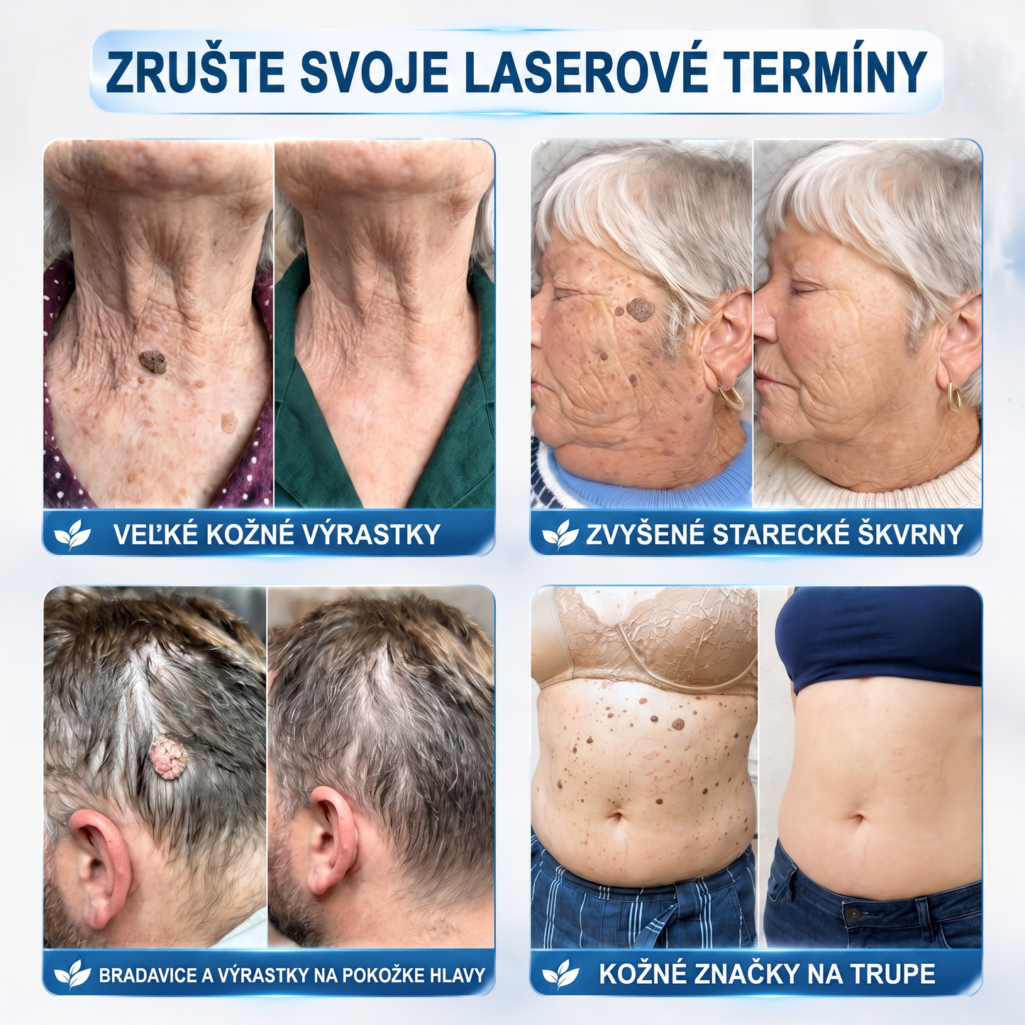 HISKIN®👩‍⚕️ BOTANICKÝ – GUMA NA ŠTÍTKY A ŠKVRNY – Bezbolestná starostlivosť o pokožku bez jaziev s pokročilým guľôčkovým aplikátorom